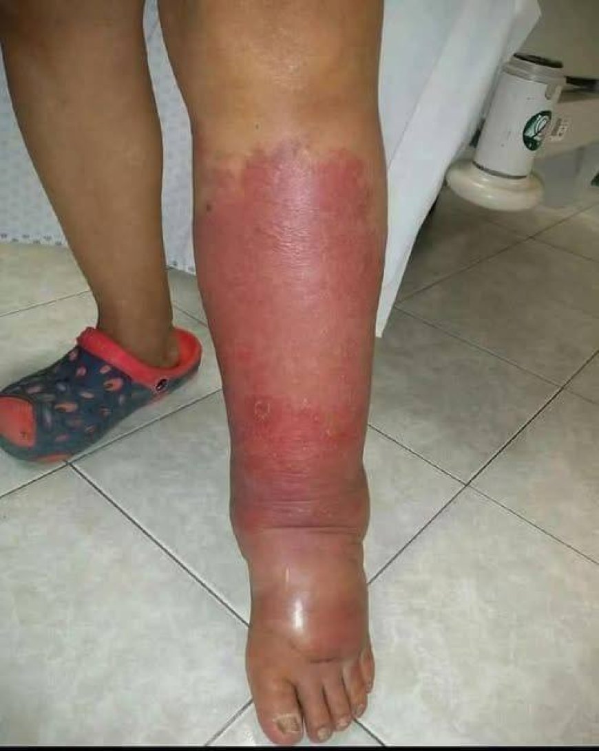 1-TG Health Warning Signs on Your Feet You Should Never Ignore