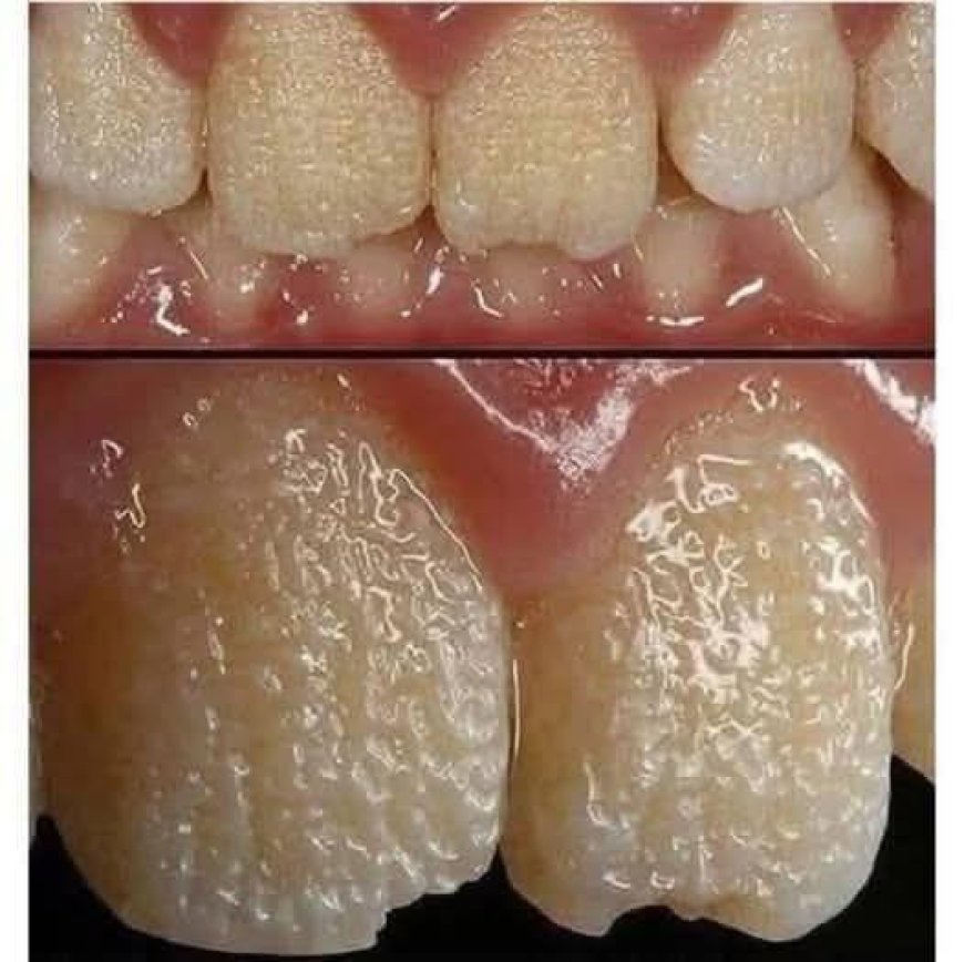 🚨🚨Be careful!! This is what your teeth will become when you eat…